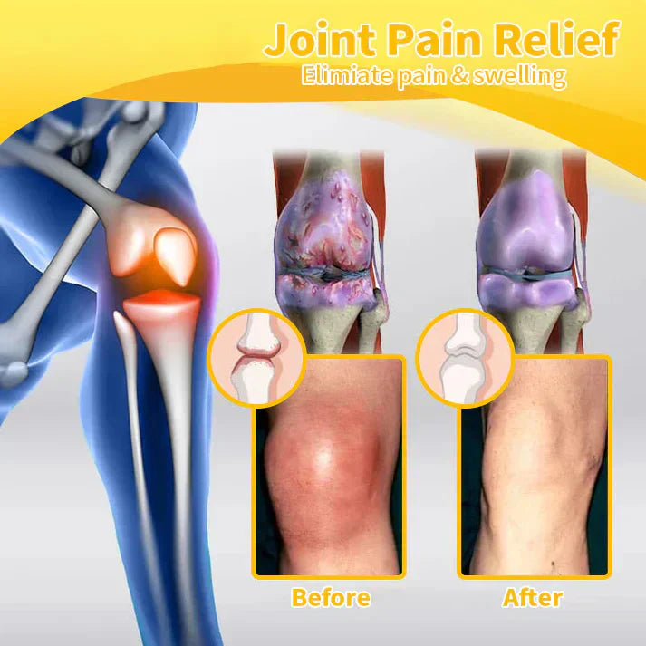 PainCare™ Schmerzlinderungsgel - Klinisch geprüfte Arthrose- und Gelenkschmerztherapie