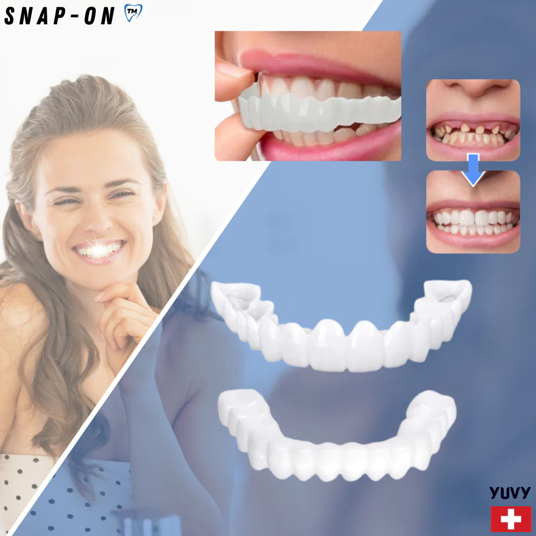 SnapOn™ Top and Bottom Veneer Set - Transform Your Smile in Seconds