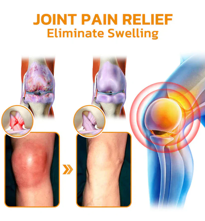 PainCare™ Schmerzlinderungsgel - Klinisch geprüfte Arthrose- und Gelenkschmerztherapie