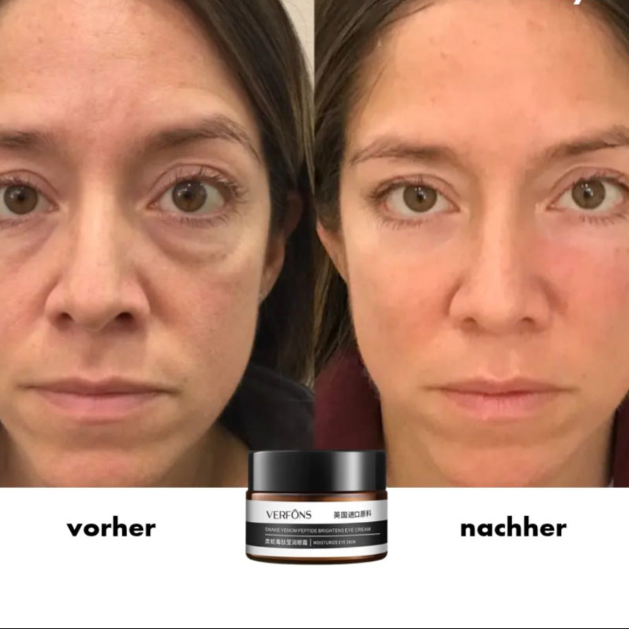 VisuAge™ Intensiv-Augenpflege