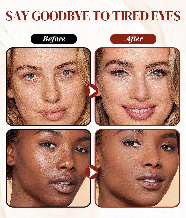 YUVY™ Coloured Clay Undereye Corrector - Erase Years of Tiredness in 30 Seconds