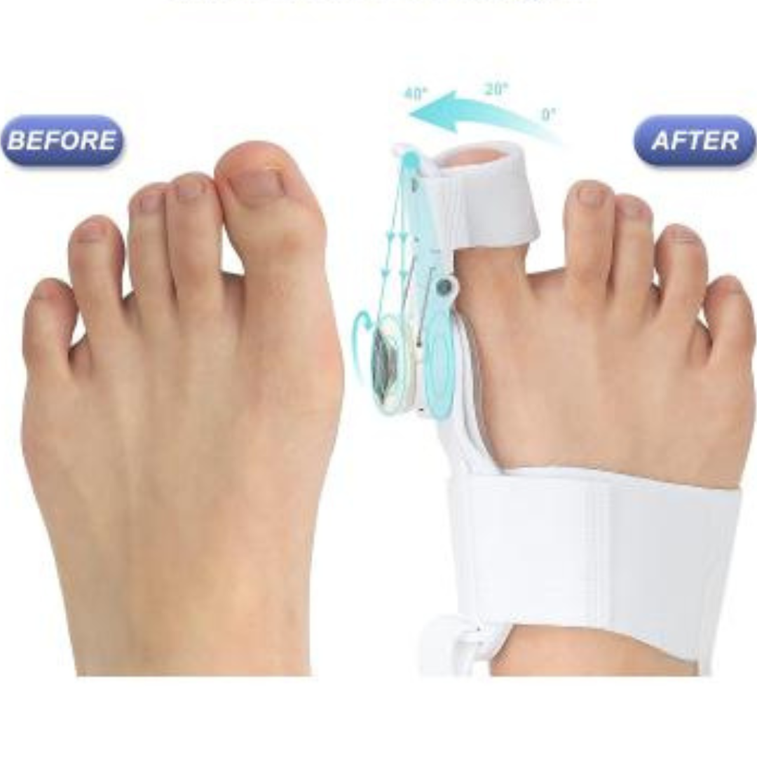 ComfortAlign™ Hallux-Korrektur