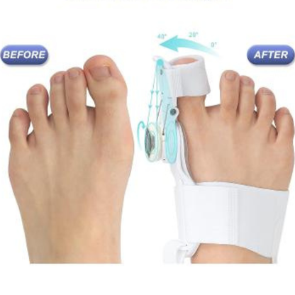 ComfortAlign™ Hallux-Korrektur