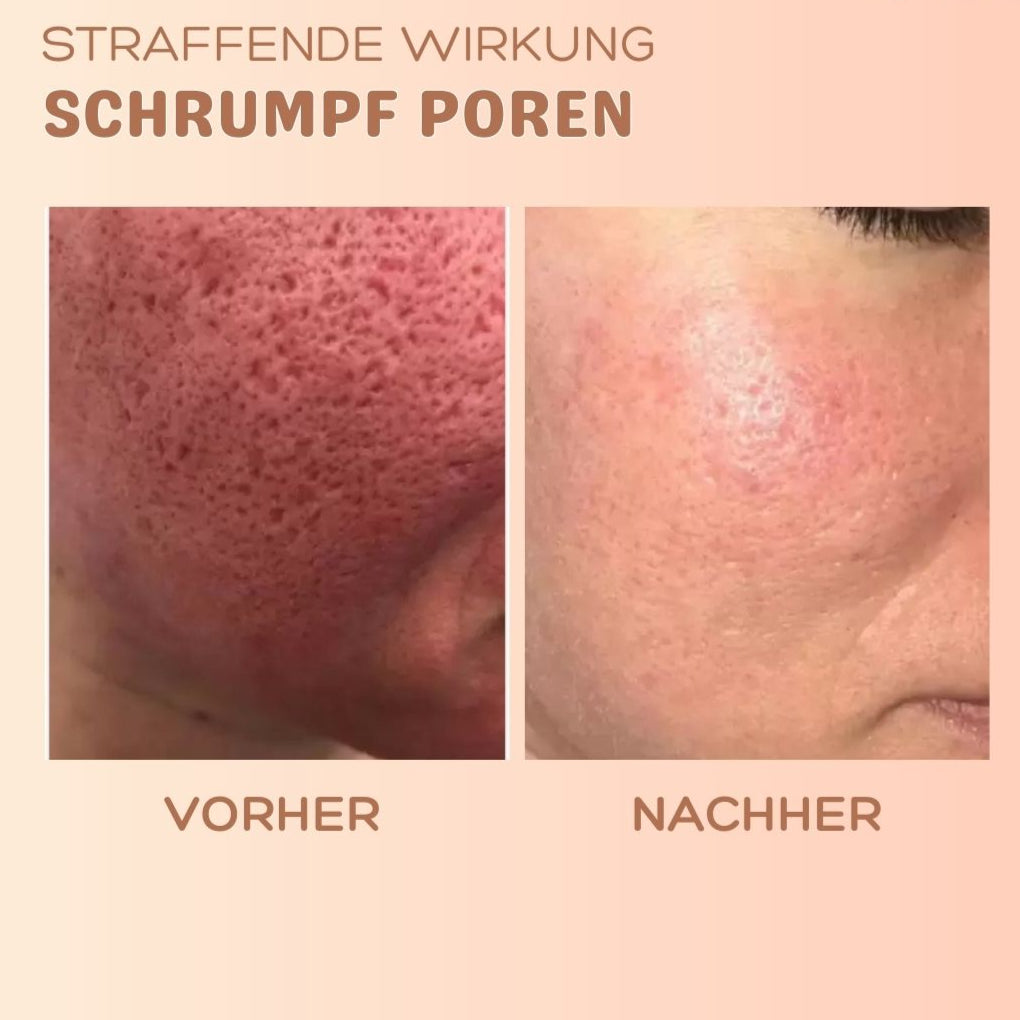 Skin brightness™ Faltenkorrektur Balsam