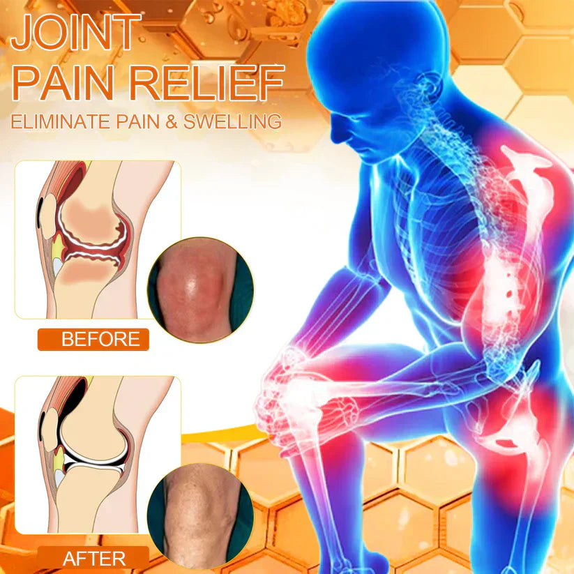 PainCare™ Schmerzlinderungsgel - Klinisch geprüfte Arthrose- und Gelenkschmerztherapie