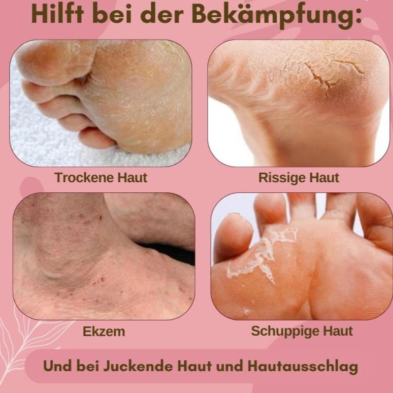 FootVitalize™ Fußpflege-Creme – Für weiche, gesunde Füße in nur wenigen Anwendungen!