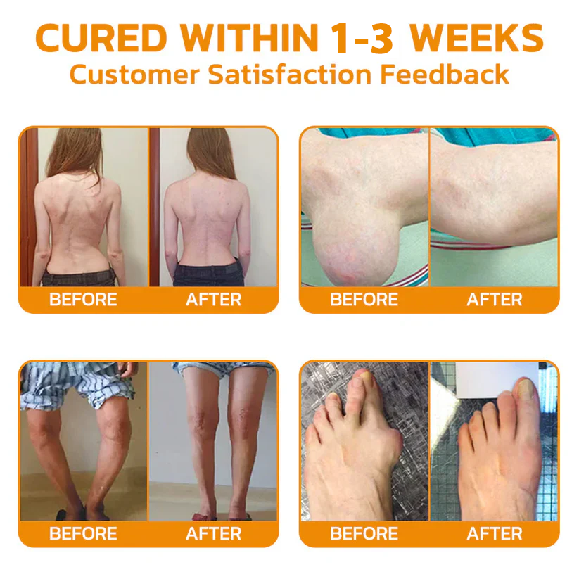 PainCare™ Schmerzlinderungsgel - Klinisch geprüfte Arthrose- und Gelenkschmerztherapie