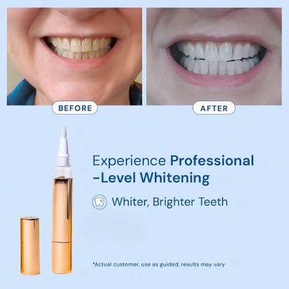 Yuvy™ Professional Whitening Pen - Transform Your Smile in Just 3 Minutes Daily
