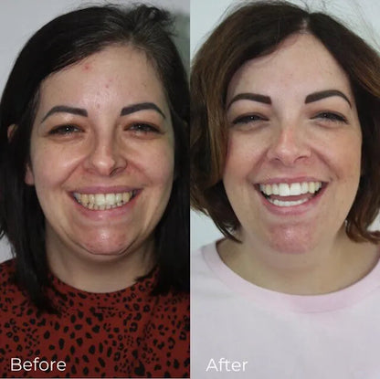 smilekit™ Purple Brightening Toothpaste - Professional Results at Home in Minutes