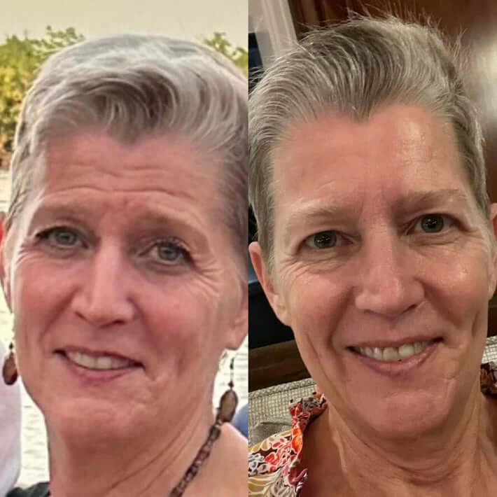 NuSkin™ - Αποκτήστε ξανά τη νεανική εμφάνιση της επιδερμίδας σας