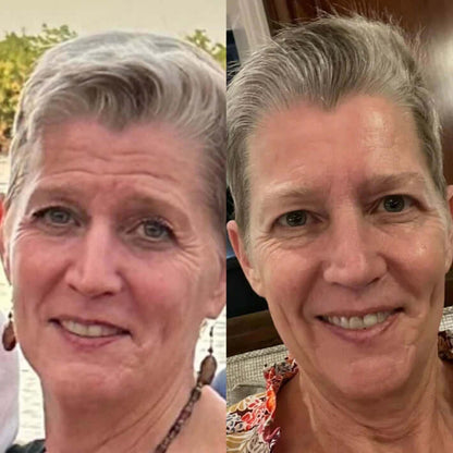 NuSkin™ - Αποκτήστε ξανά τη νεανική εμφάνιση της επιδερμίδας σας