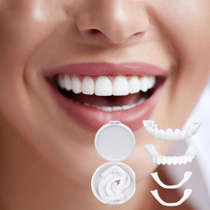 SnapOn™ Top and Bottom Veneer Set - Transform Your Smile in Seconds