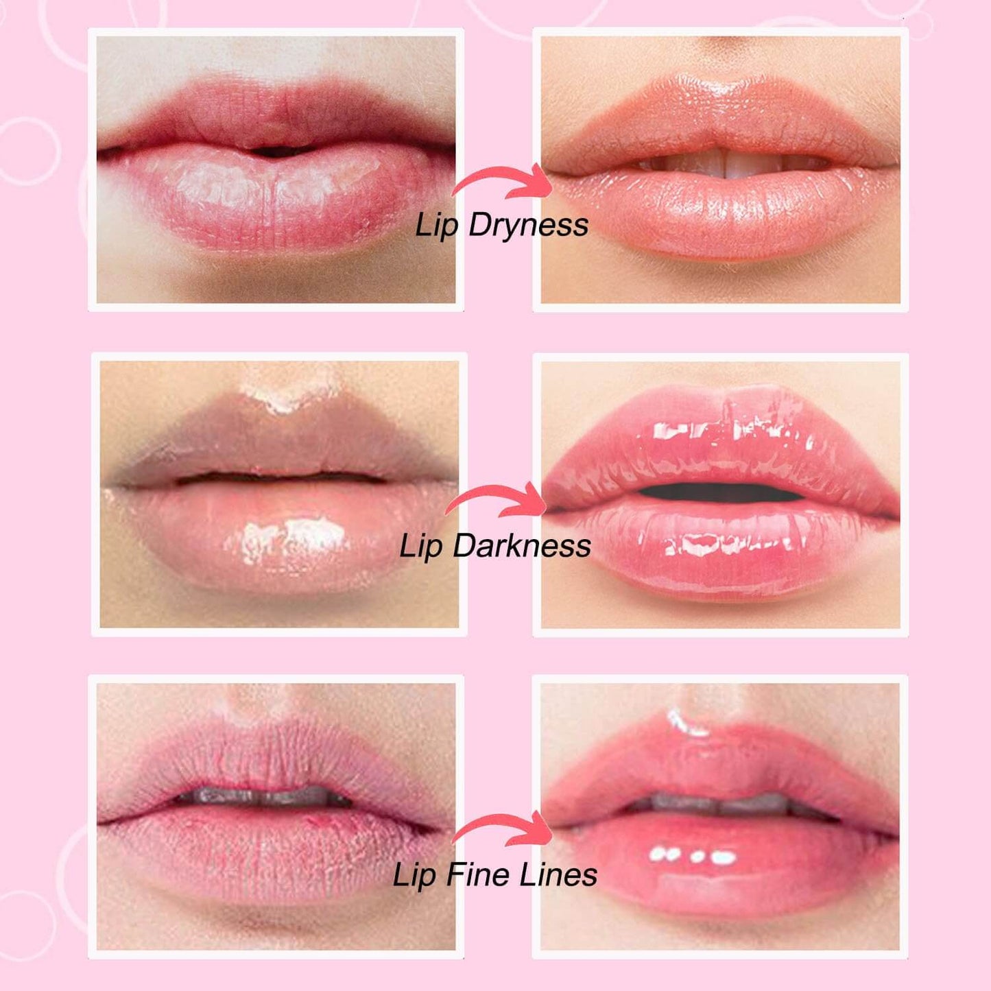 YUVY™ Collagen Crystal Lip Masks - Transform Dry Lips Into Plump, Kissable Perfection