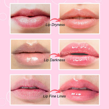 YUVY™ Collagen Crystal Lip Masks - Transform Dry Lips Into Plump, Kissable Perfection