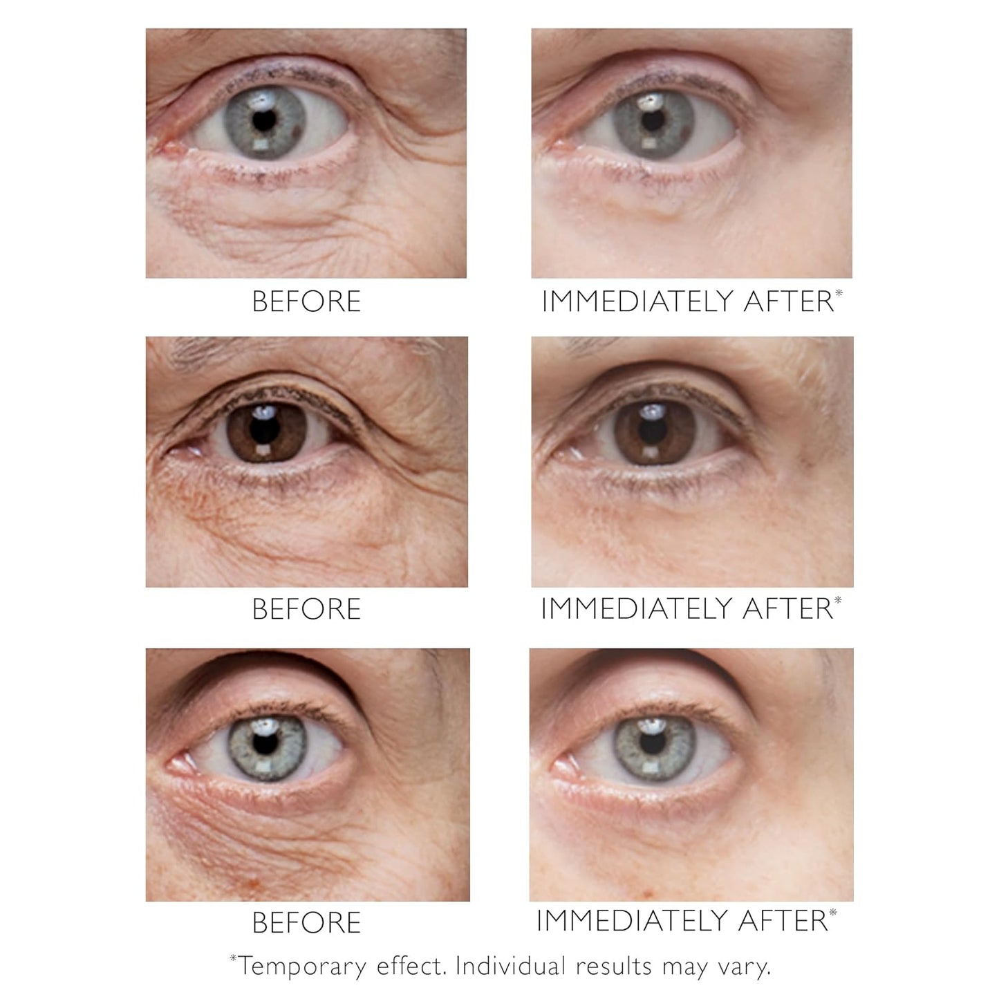 EyeLift™ Sofort-Straffer für jugendlichen Augenausdruck