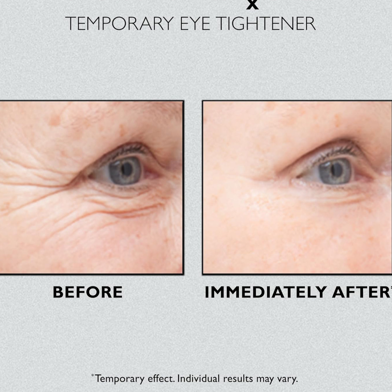 EyeLift™ Sofort-Straffer für jugendlichen Augenausdruck