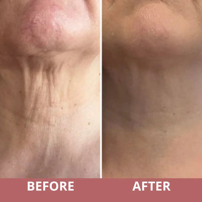 TIGHTEN & LIFT NECK CREAM by Yuvy