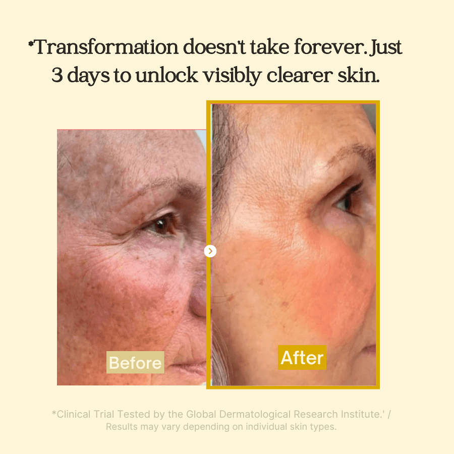 Yuvy™ Turmeric Kojic Acid + Collagen Night Mask - Fade Dark Spots While You Sleep