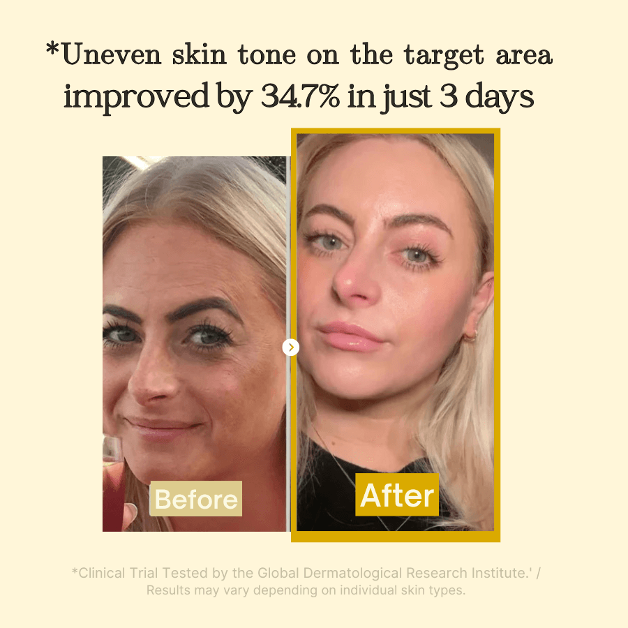 Yuvy™ Turmeric Kojic Acid + Collagen Night Mask - Fade Dark Spots While You Sleep