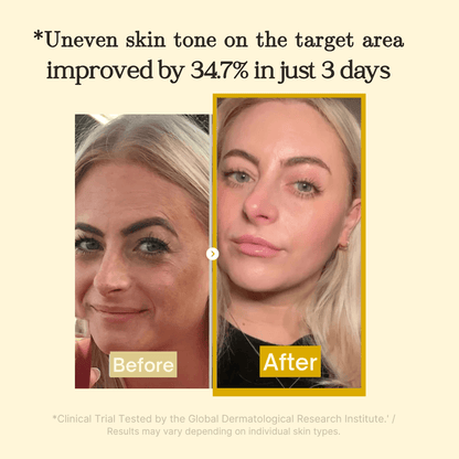 Yuvy™ Turmeric Kojic Acid + Collagen Night Mask - Fade Dark Spots While You Sleep