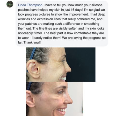 NuSkin™ - Αποκτήστε ξανά τη νεανική εμφάνιση της επιδερμίδας σας