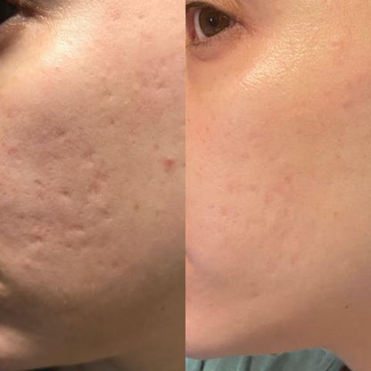 NuSkin™ - Αποκτήστε ξανά τη νεανική εμφάνιση της επιδερμίδας σας