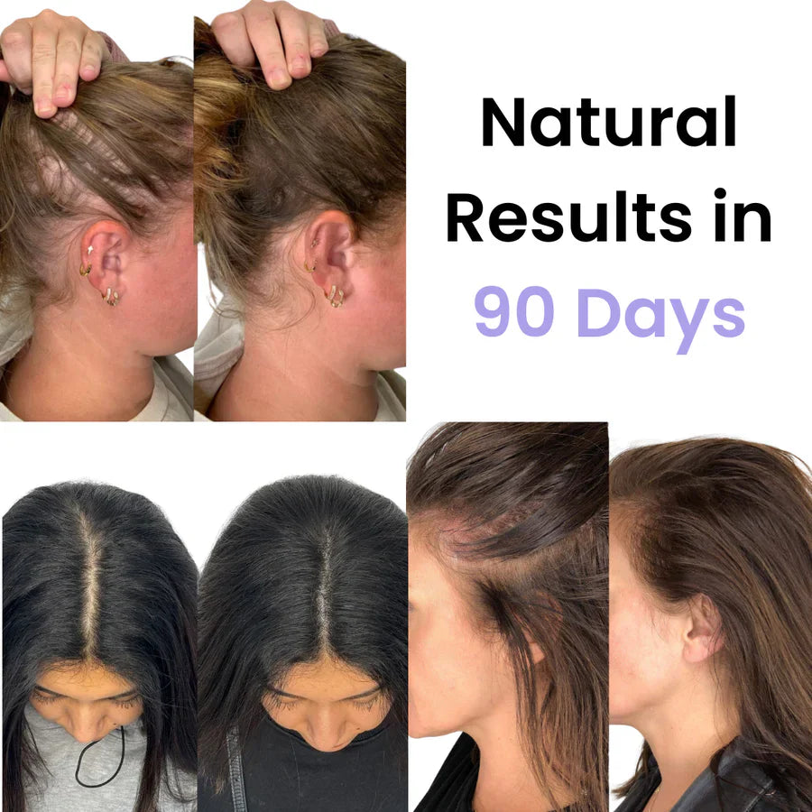 Vibrant Hair™ Professionelle Haartherapie-Bürste | Für gesundes, kräftiges Haar