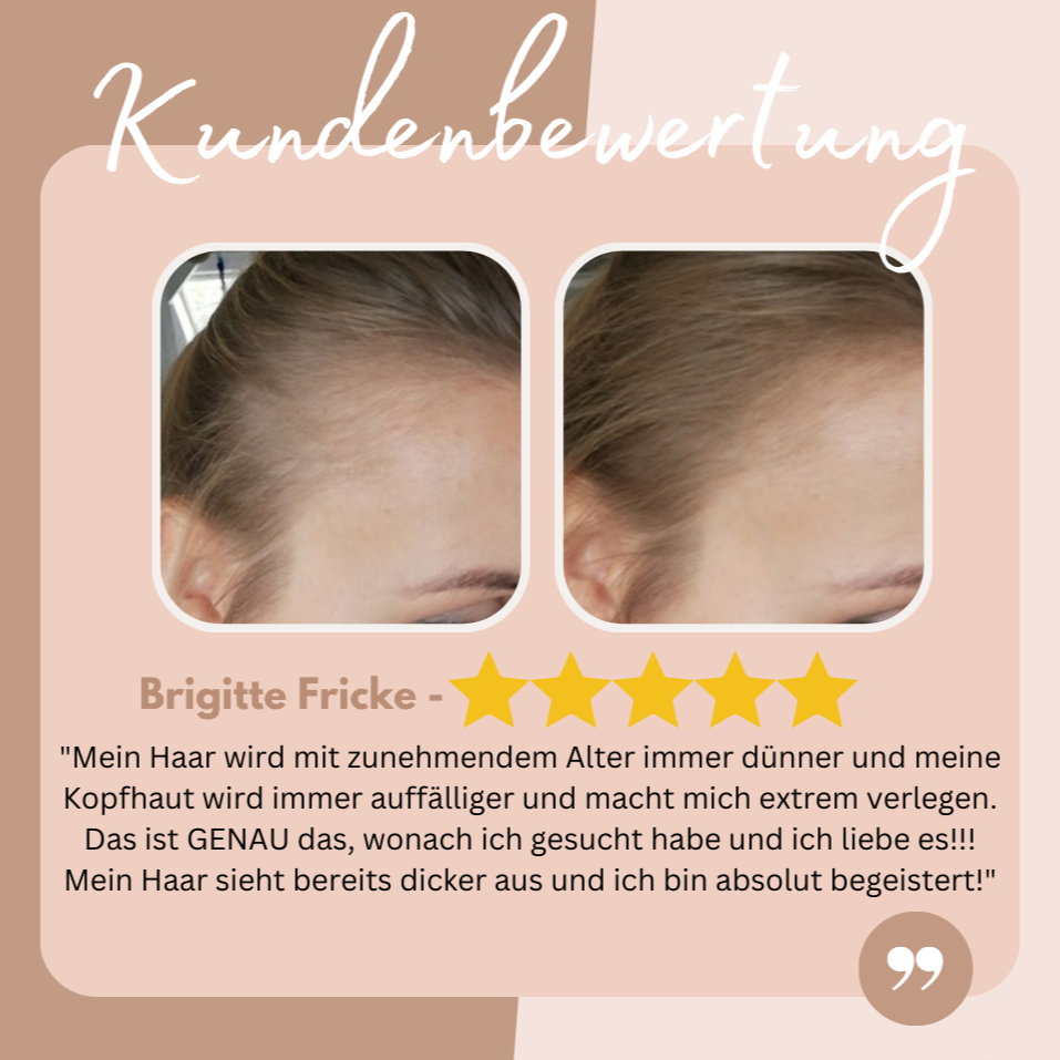 EasyBlend™ Haaransatz-Abdeckung – Deckt graue und dünne Stellen in Sekunden!