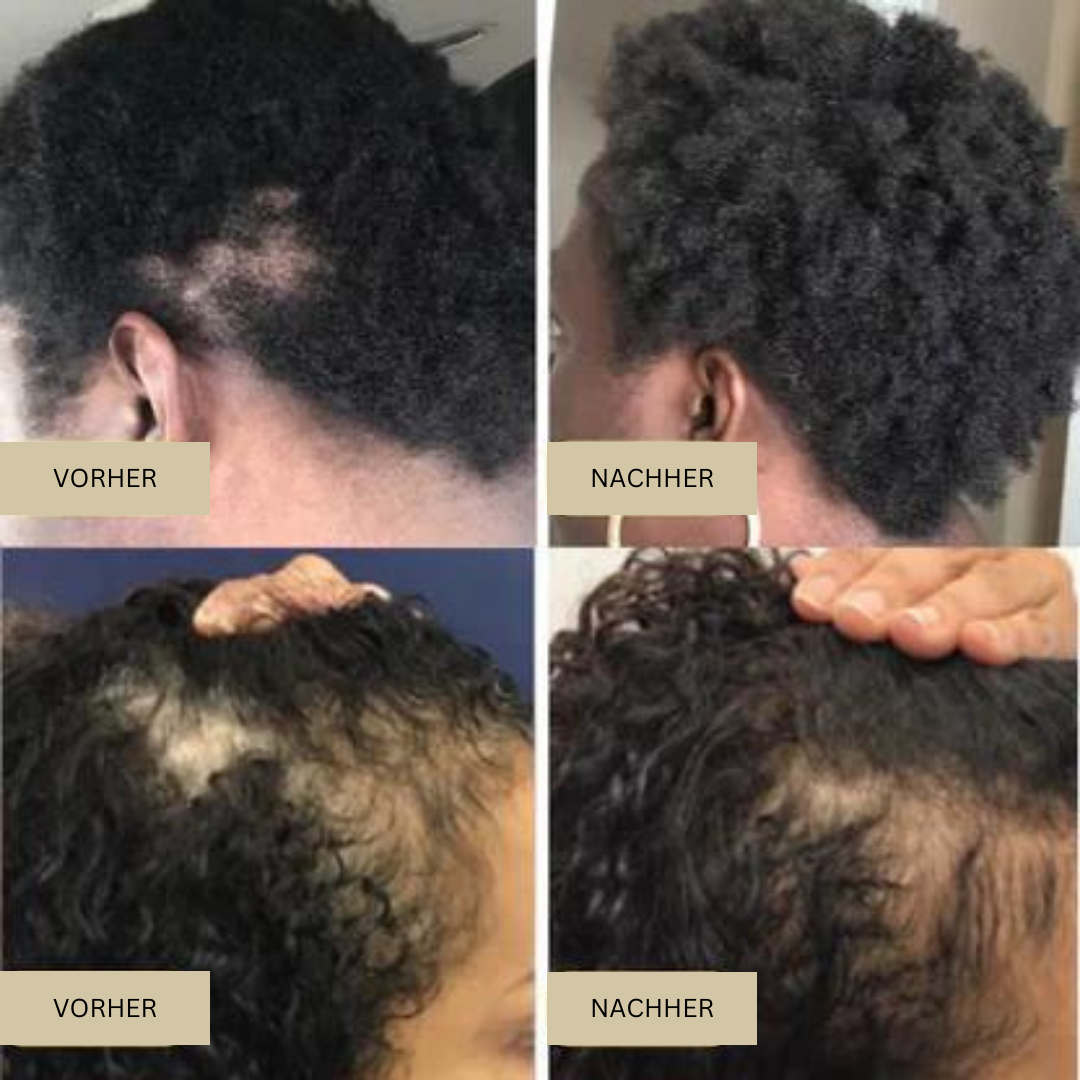 NaturVital™ Haaröl για natürliches Selbstvertrauen