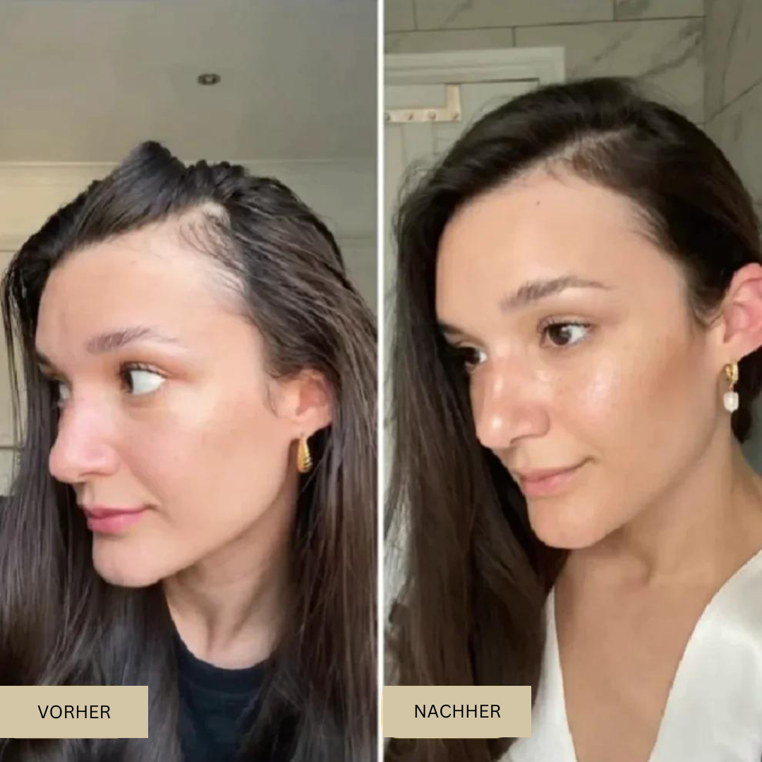 NaturVital™ Haaröl για natürliches Selbstvertrauen