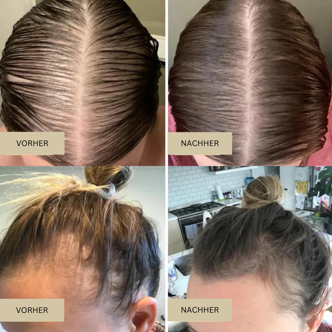 NaturVital™ Haaröl για natürliches Selbstvertrauen