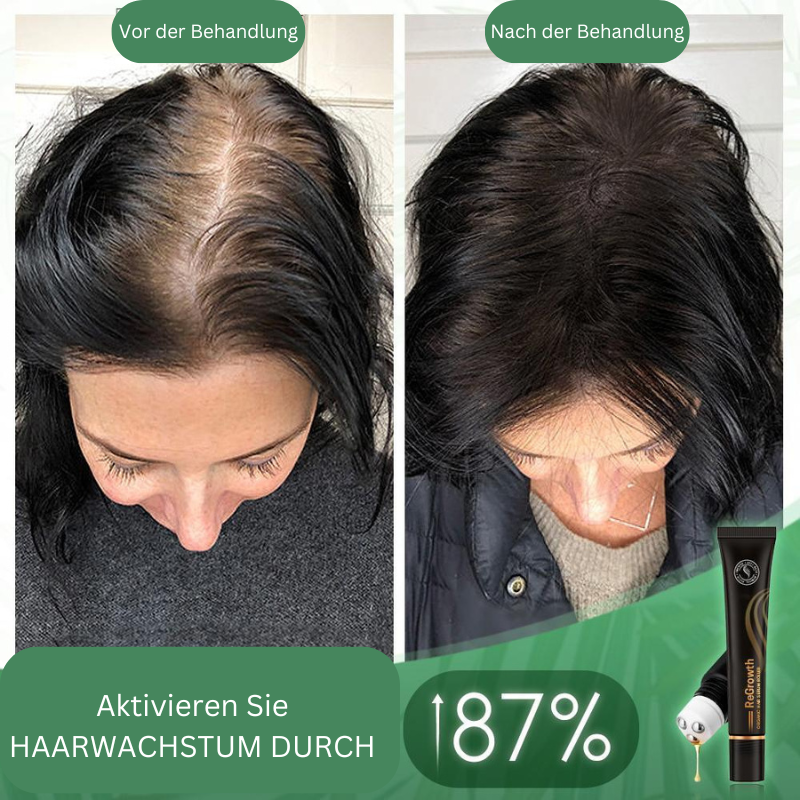 HairBoost™ Βιολογικός Ορός Μαλλιών σε Ρολό (Αγοράστε 1 Πάρτε 1 Δωρεάν)