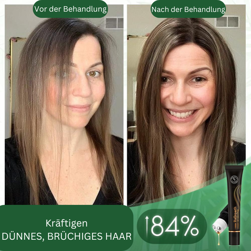 HairBoost™ Βιολογικός Ορός Μαλλιών σε Ρολό (Αγοράστε 1 Πάρτε 1 Δωρεάν)