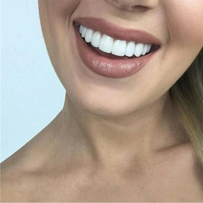 SnapOn™ Top and Bottom Veneer Set - Transform Your Smile in Seconds