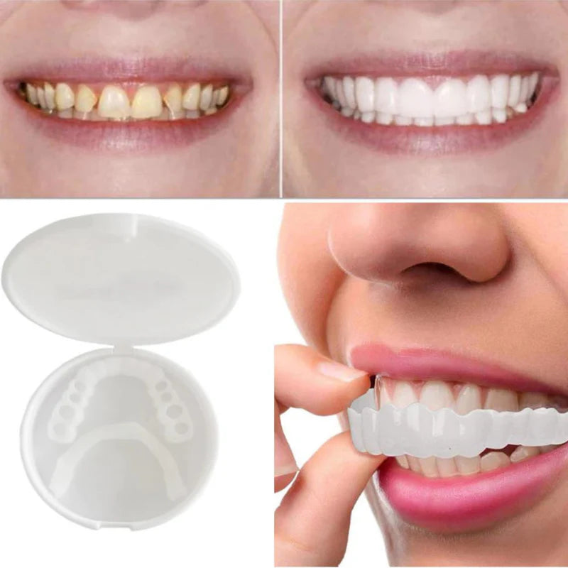 SnapOn™ Top and Bottom Veneer Set - Transform Your Smile in Seconds