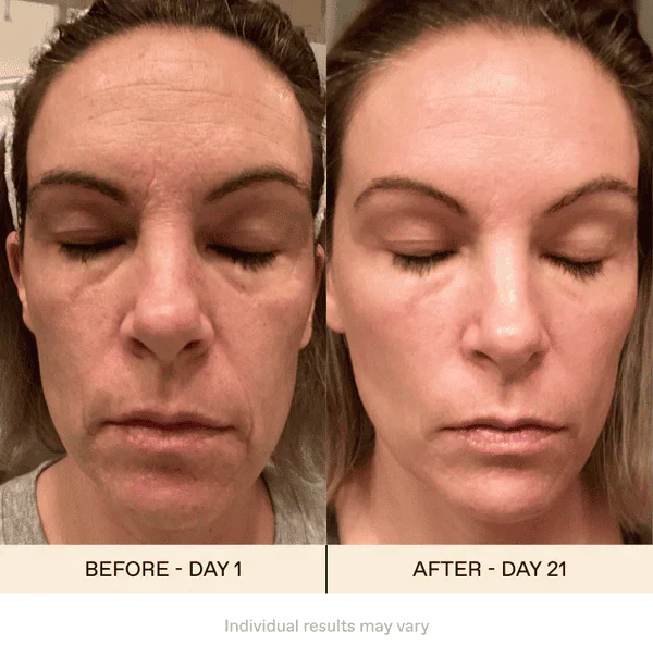 BeautyEyes™ Professioneller Augenpflege-Stab