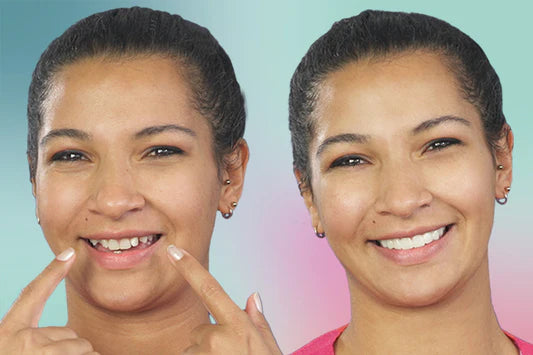 SnapOn™ Top and Bottom Veneer Set - Transform Your Smile in Seconds