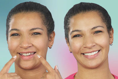 SnapOn™ Top and Bottom Veneer Set - Transform Your Smile in Seconds