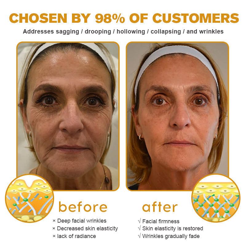 Furzero™ – Radiant Skin, Greater Confidence
