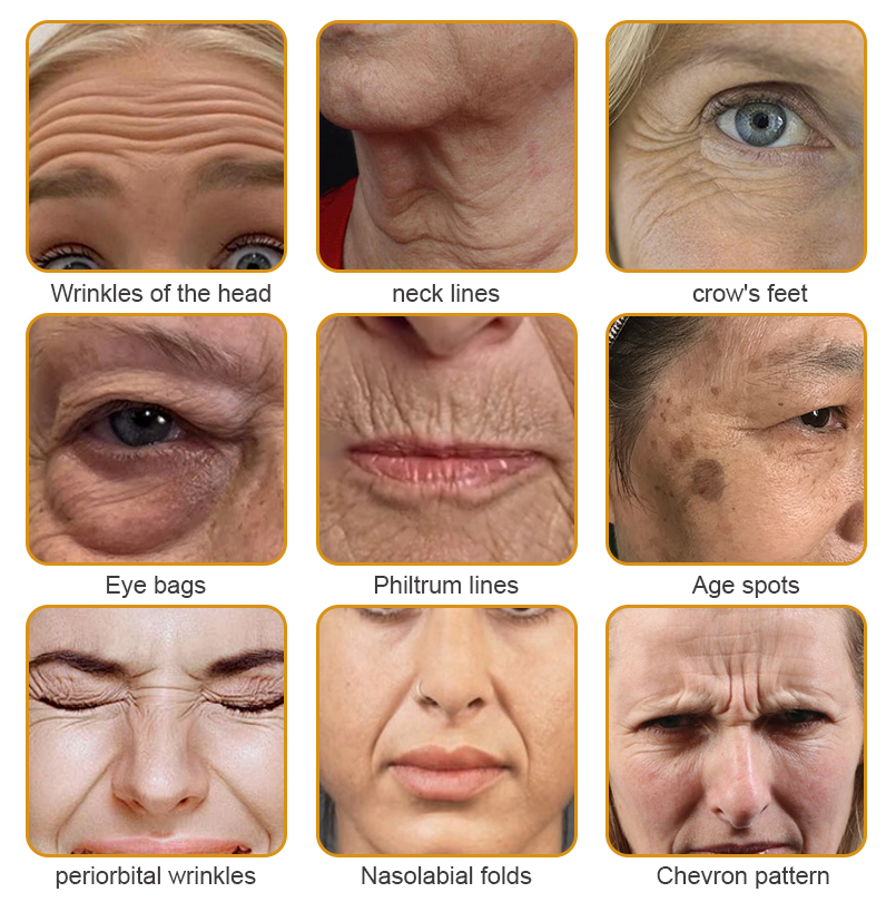 Furzero™ – Radiant Skin, Greater Confidence