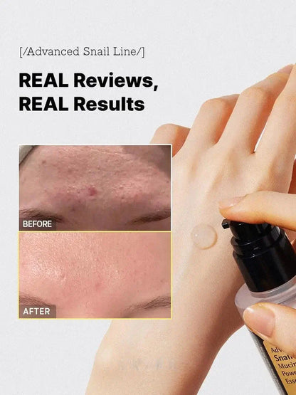 YUVY Advanced Snail 96 Mucin Power Essence